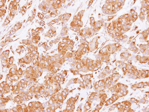 RUFY1 Antibody in Immunohistochemistry (Paraffin) (IHC (P))