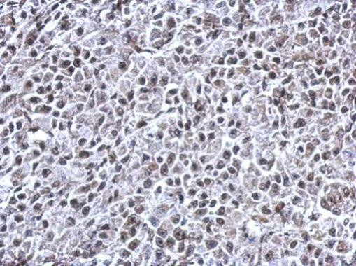 RNF180 Antibody in Immunohistochemistry (Paraffin) (IHC (P))