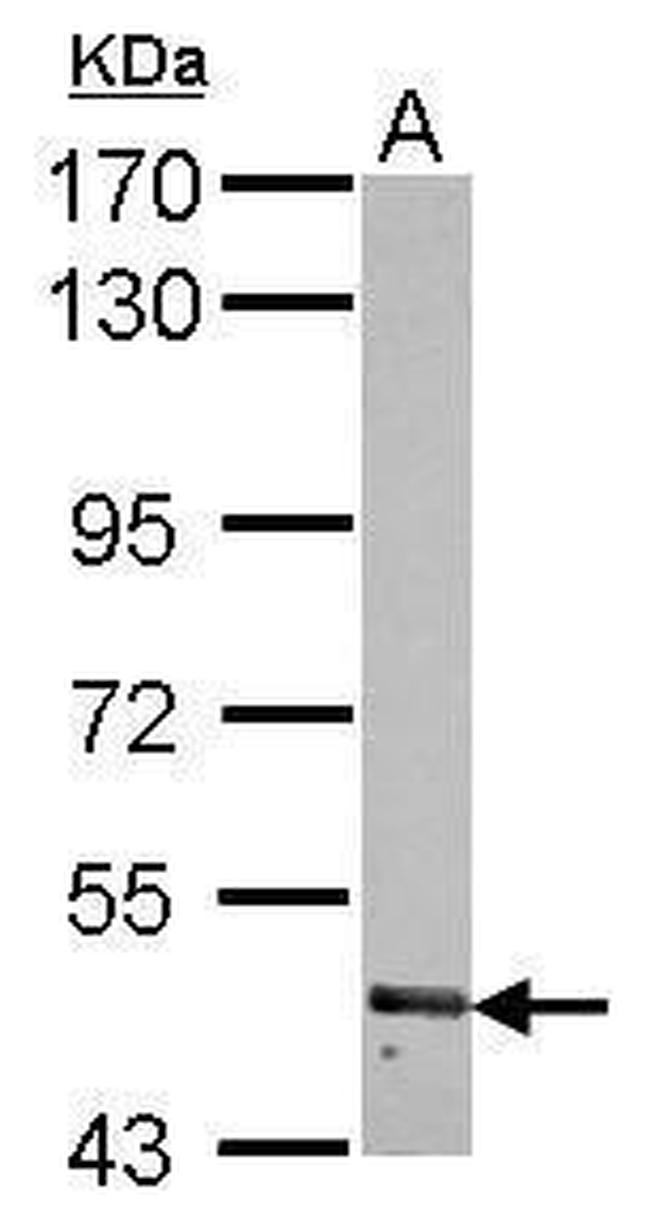 RNF180 Antibody in Western Blot (WB)