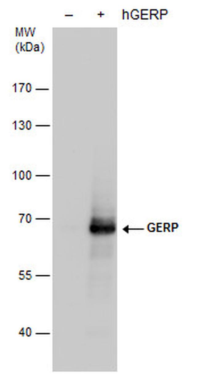 TRIM8 Antibody in Western Blot (WB)
