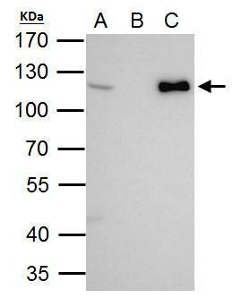 CHD1L Antibody in Immunoprecipitation (IP)