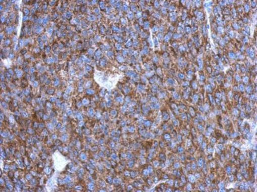 OVCA2 Antibody in Immunohistochemistry (Paraffin) (IHC (P))