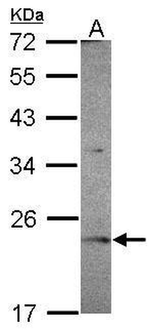 OVCA2 Antibody in Western Blot (WB)