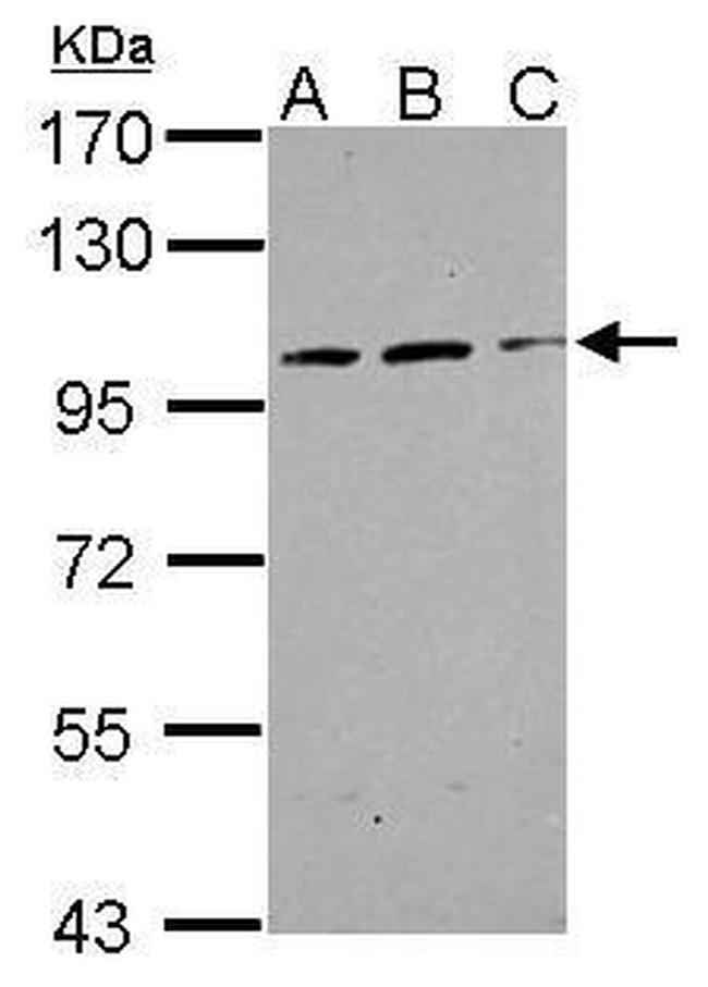 TRAK2 Polyclonal Antibody (PA5-31459)