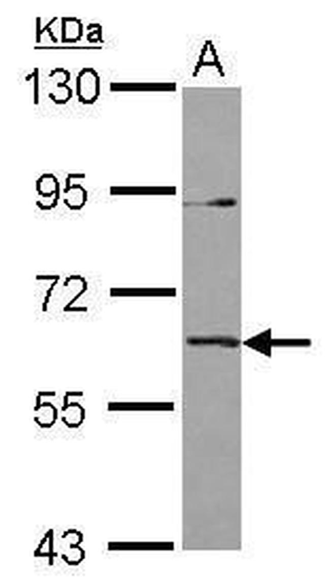 IL1RL2 Antibody in Western Blot (WB)