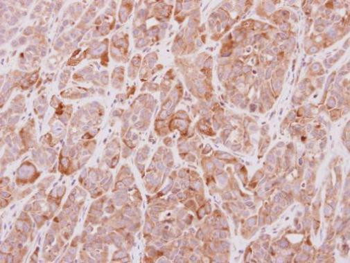 MGAT4A Antibody in Immunohistochemistry (Paraffin) (IHC (P))