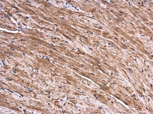 EXOC1 Antibody in Immunohistochemistry (Paraffin) (IHC (P))