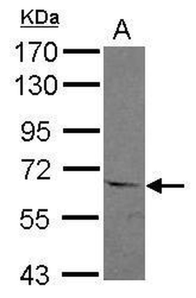 ASC1 Antibody in Western Blot (WB)