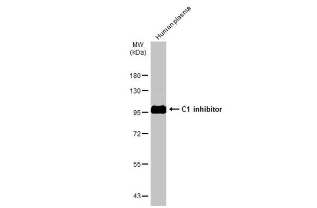 C1 inhibitor Antibody in Western Blot (WB)