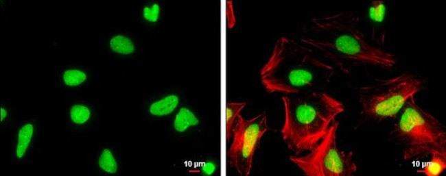 WDR62 Antibody in Immunocytochemistry (ICC/IF)