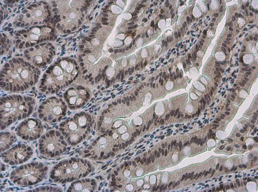 PYGO2 Antibody in Immunohistochemistry (Paraffin) (IHC (P))