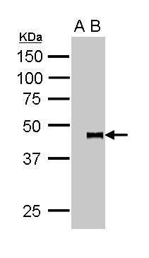 PYGO2 Antibody in Immunoprecipitation (IP)