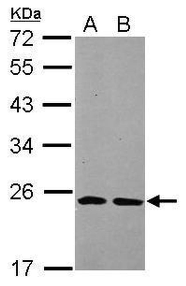 THOC7 Antibody in Western Blot (WB)