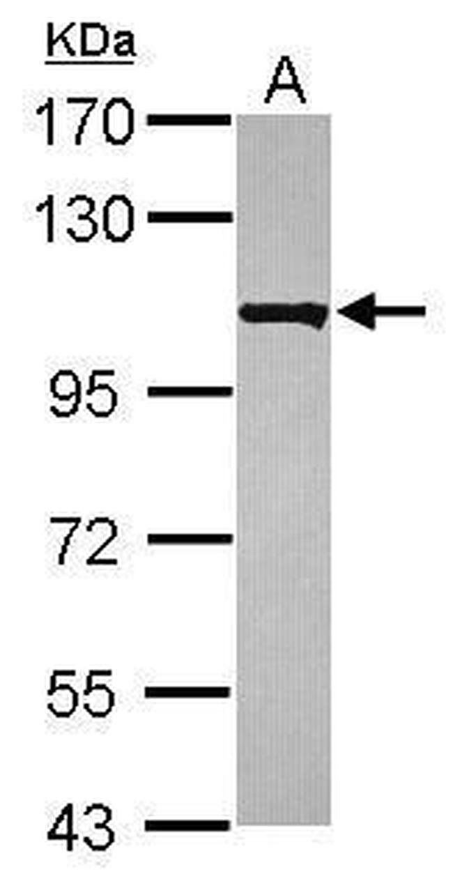 KIAA0090 Antibody in Western Blot (WB)