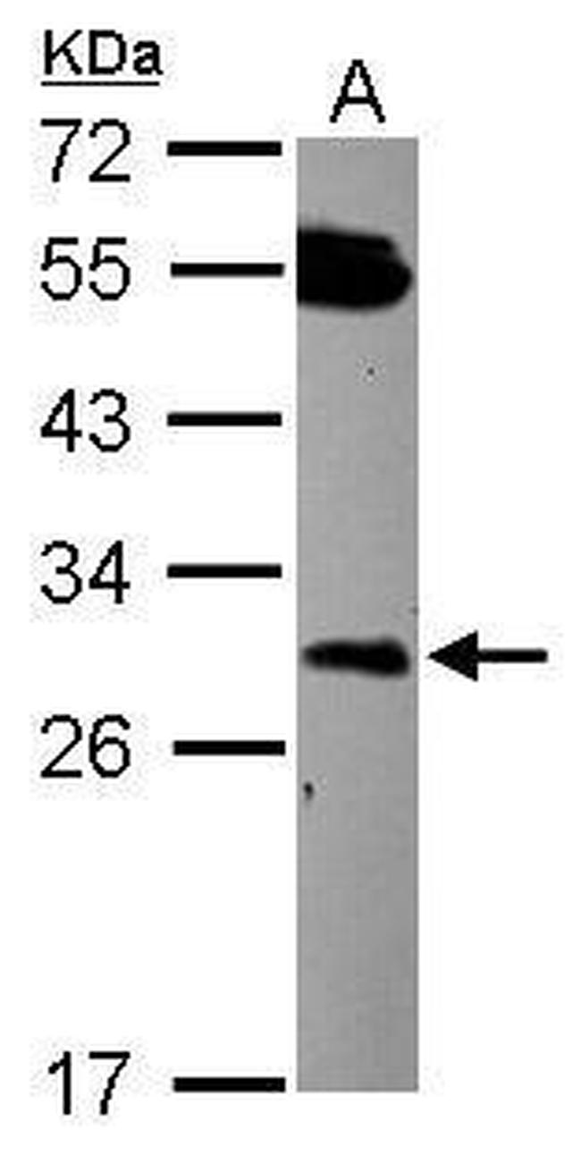 DCUN1D2 Antibody in Western Blot (WB)