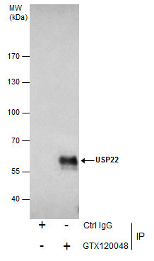 USP22 Antibody in Immunoprecipitation (IP)