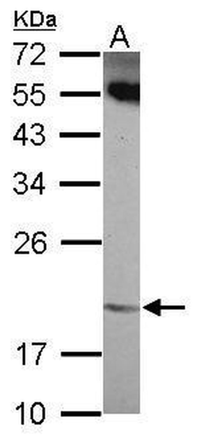 ANKRD39 Antibody in Western Blot (WB)