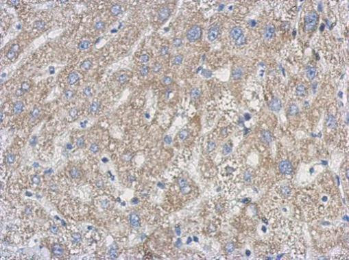 UPRT Antibody in Immunohistochemistry (Paraffin) (IHC (P))