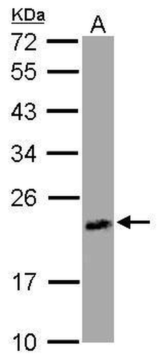 UPRT Antibody in Western Blot (WB)