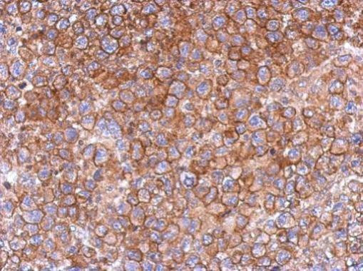 FCHO2 Antibody in Immunohistochemistry (Paraffin) (IHC (P))