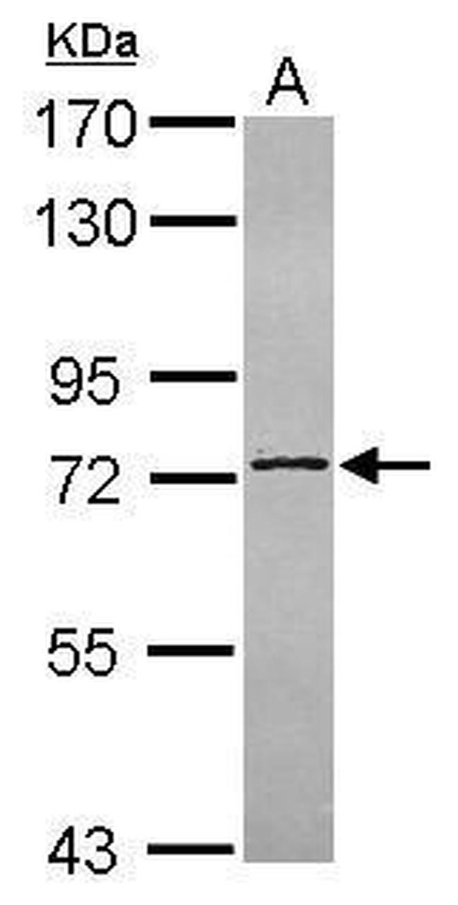 C14orf21 Antibody in Western Blot (WB)