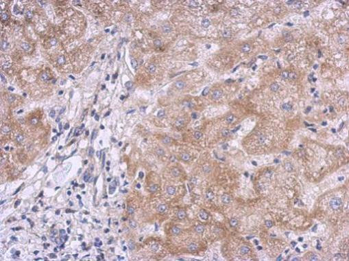 KLHL21 Antibody in Immunohistochemistry (Paraffin) (IHC (P))