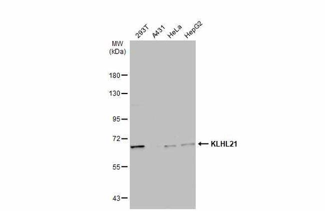 KLHL21 Antibody in Western Blot (WB)