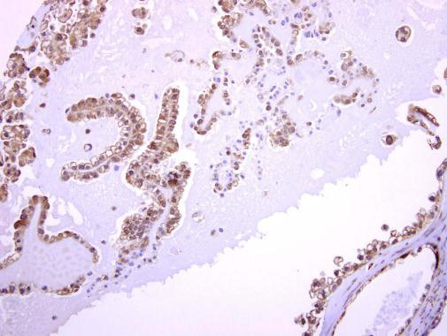 ASMTL Antibody in Immunohistochemistry (Paraffin) (IHC (P))