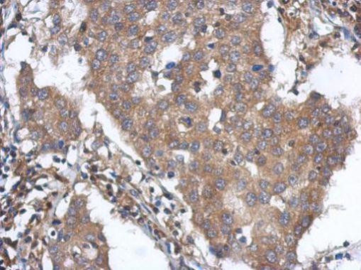 ANKLE2 Antibody in Immunohistochemistry (Paraffin) (IHC (P))