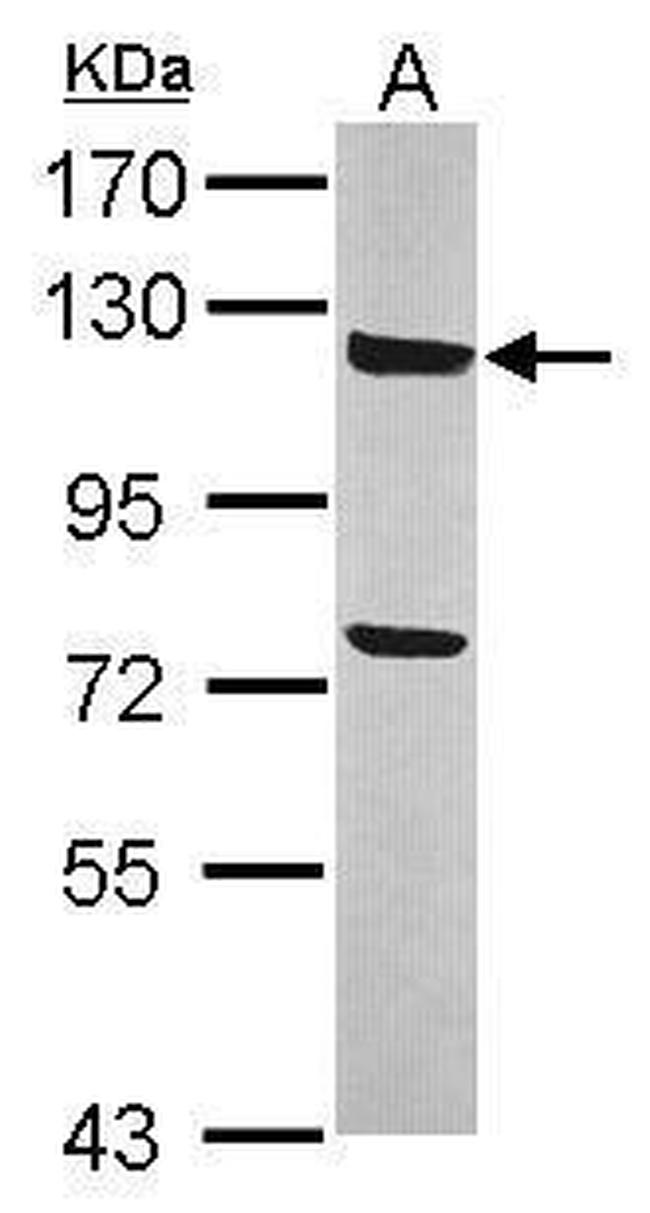 ANKLE2 Antibody in Western Blot (WB)