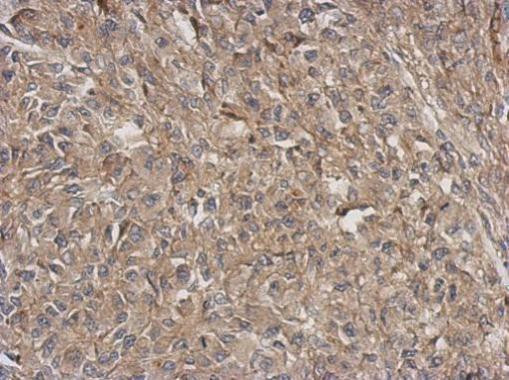 ARPC5L Antibody in Immunohistochemistry (Paraffin) (IHC (P))