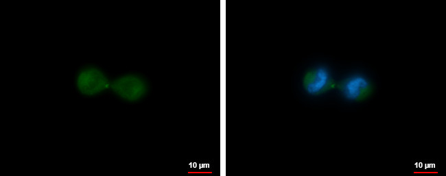 KIF23 Antibody in Immunocytochemistry (ICC/IF)