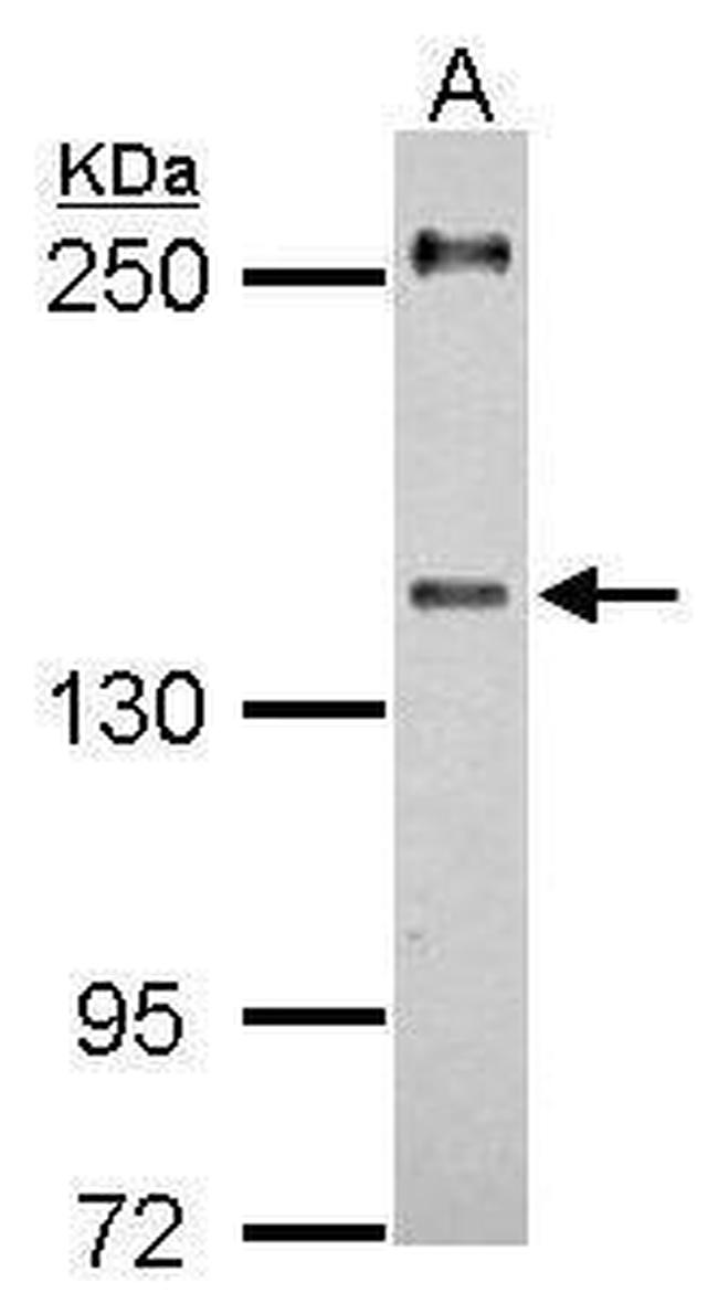 URB2 Antibody in Western Blot (WB)