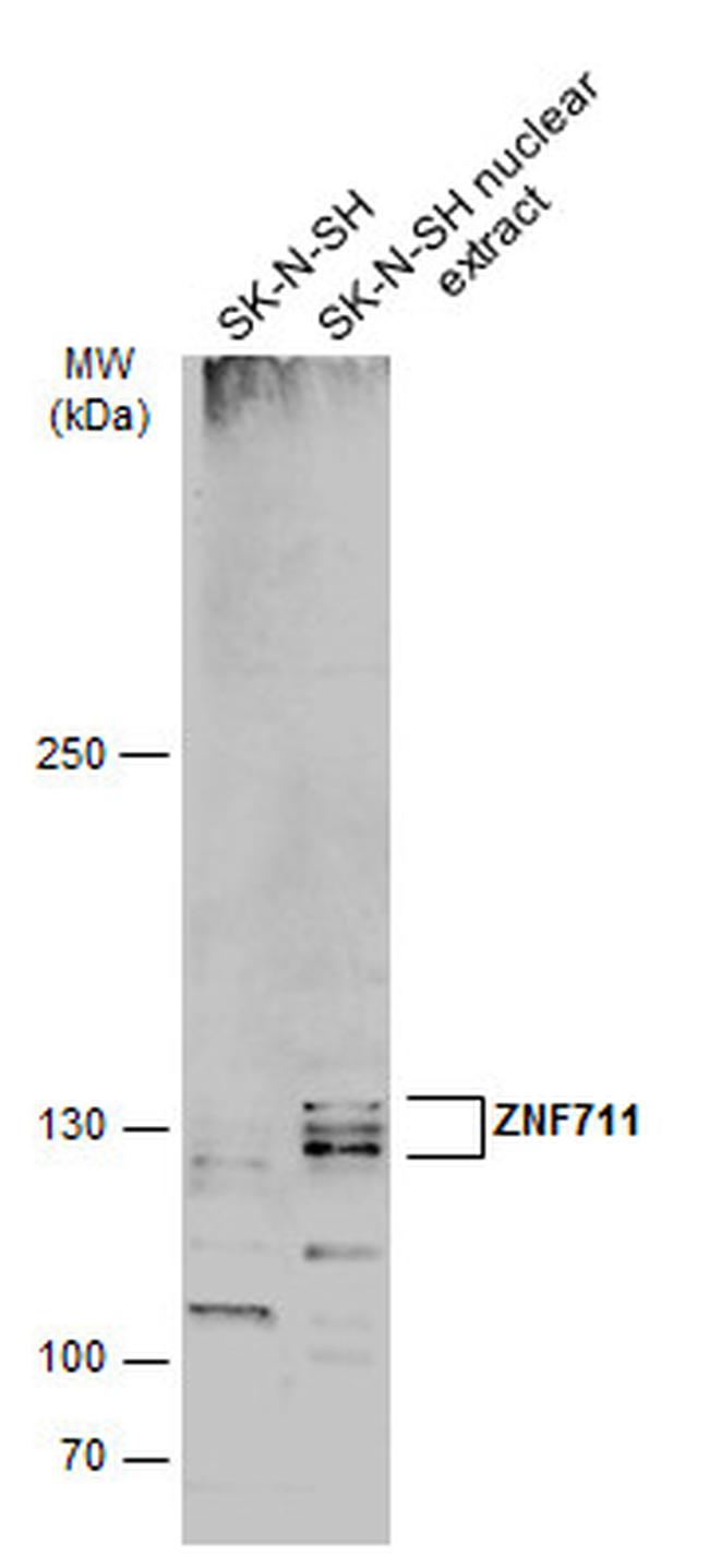 ZNF711 Antibody in Western Blot (WB)