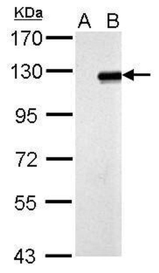 ZNF711 Antibody in Western Blot (WB)