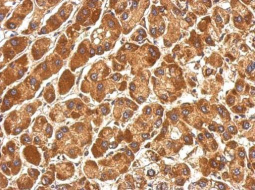 COG3 Antibody in Immunohistochemistry (Paraffin) (IHC (P))