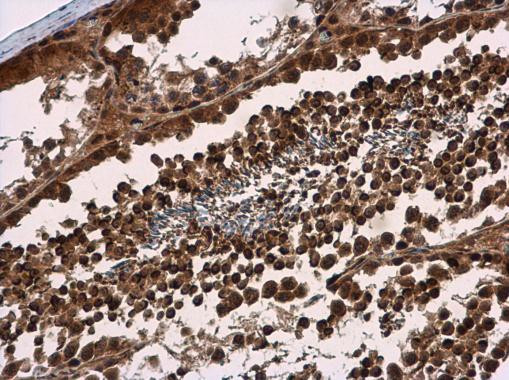 SMG7 Antibody in Immunohistochemistry (Paraffin) (IHC (P))