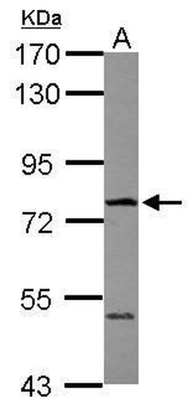 FBXO21 Antibody in Western Blot (WB)