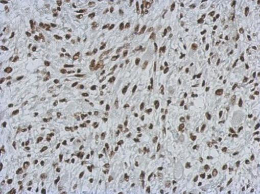 MIER3 Antibody in Immunohistochemistry (Paraffin) (IHC (P))