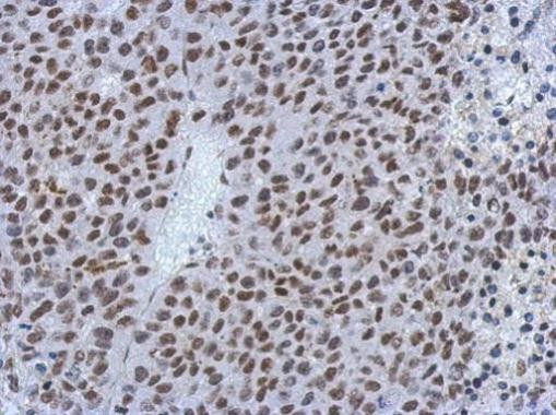 MIER3 Antibody in Immunohistochemistry (Paraffin) (IHC (P))