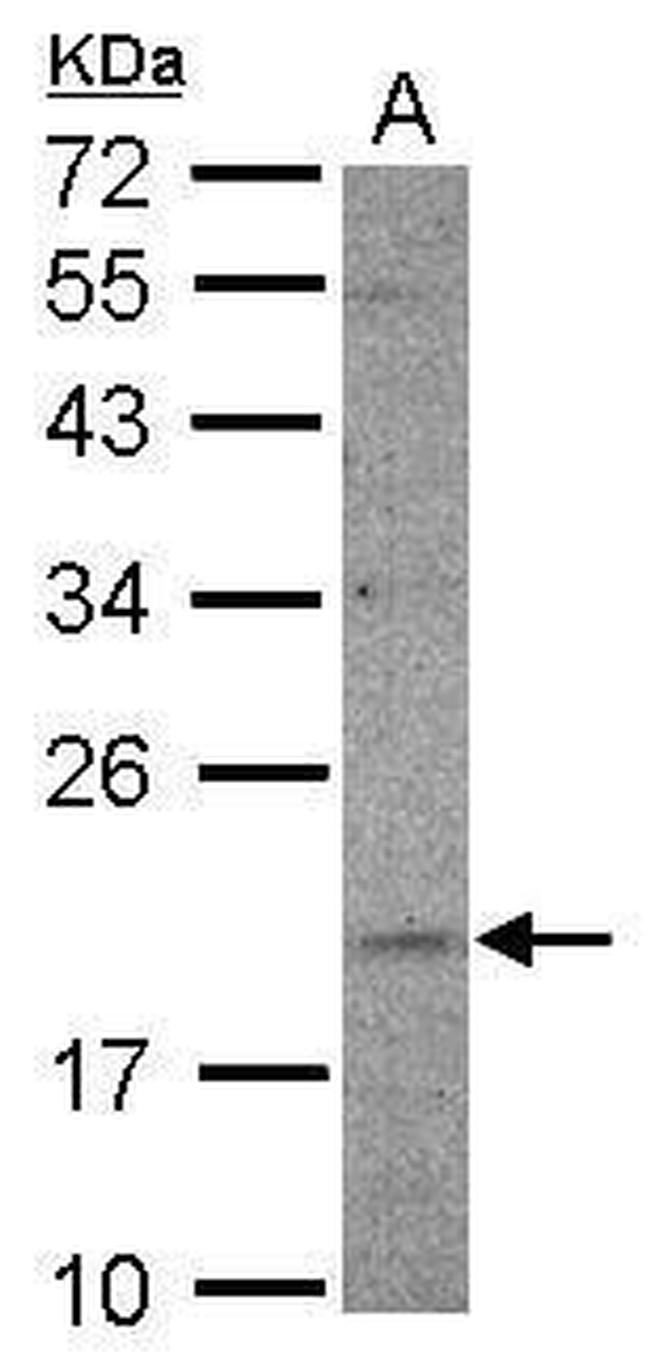 UFC1 Antibody in Western Blot (WB)