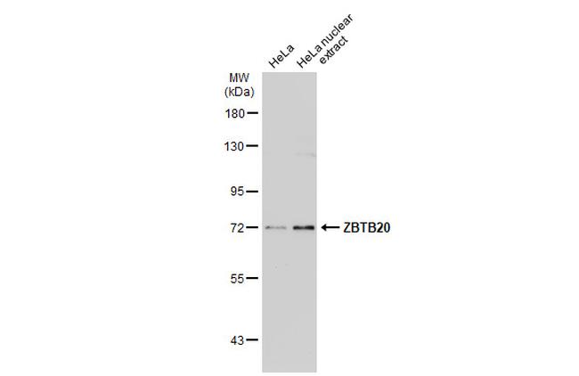 ZBTB20 Antibody in Western Blot (WB)