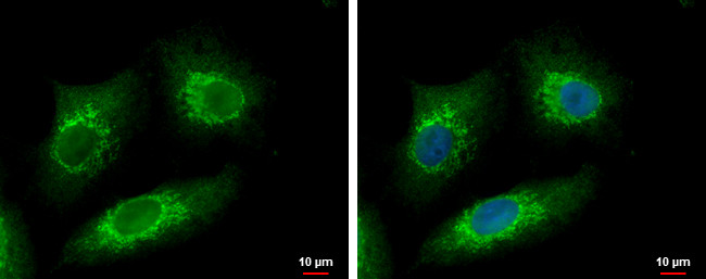 METTL6 Antibody in Immunocytochemistry (ICC/IF)