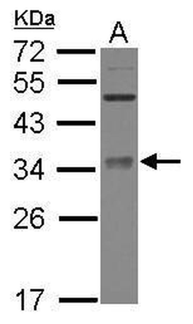 METTL6 Antibody in Western Blot (WB)