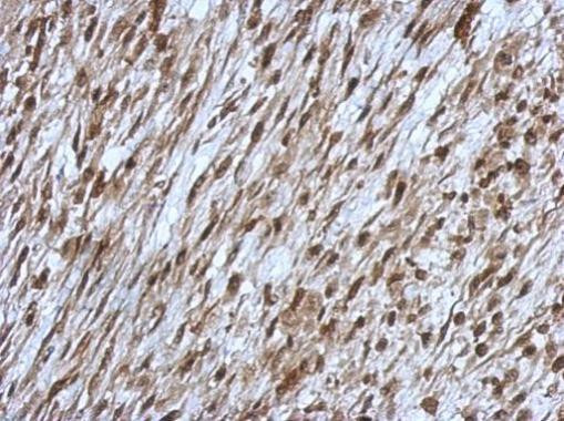 ORP9 Antibody in Immunohistochemistry (Paraffin) (IHC (P))