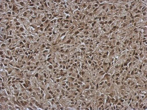 ORP9 Antibody in Immunohistochemistry (Paraffin) (IHC (P))