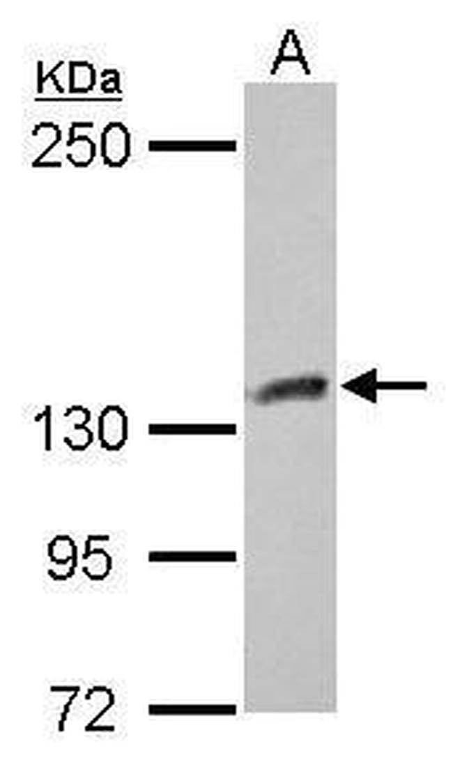 CYFIP1 Antibody in Western Blot (WB)