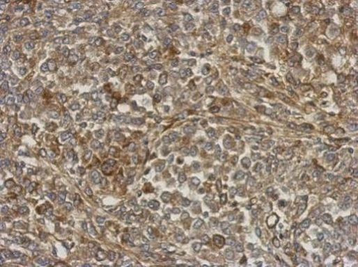 ANKRD32 Antibody in Immunohistochemistry (Paraffin) (IHC (P))