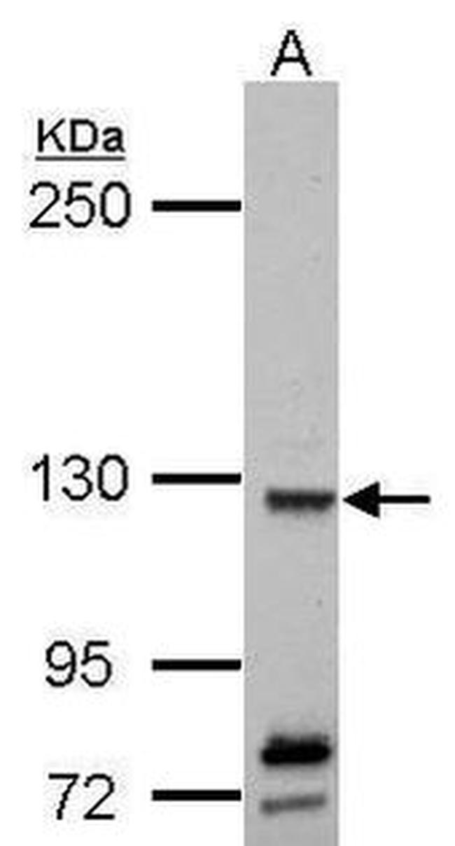 ANKRD32 Antibody in Western Blot (WB)