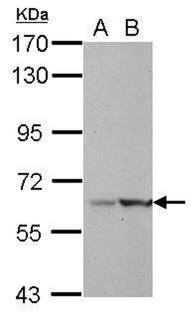 LRWD1 Antibody in Western Blot (WB)